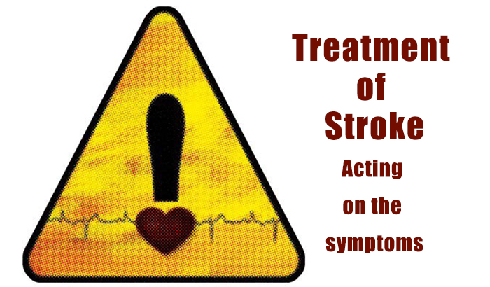 Treatment of Stroke | Healthcare Management